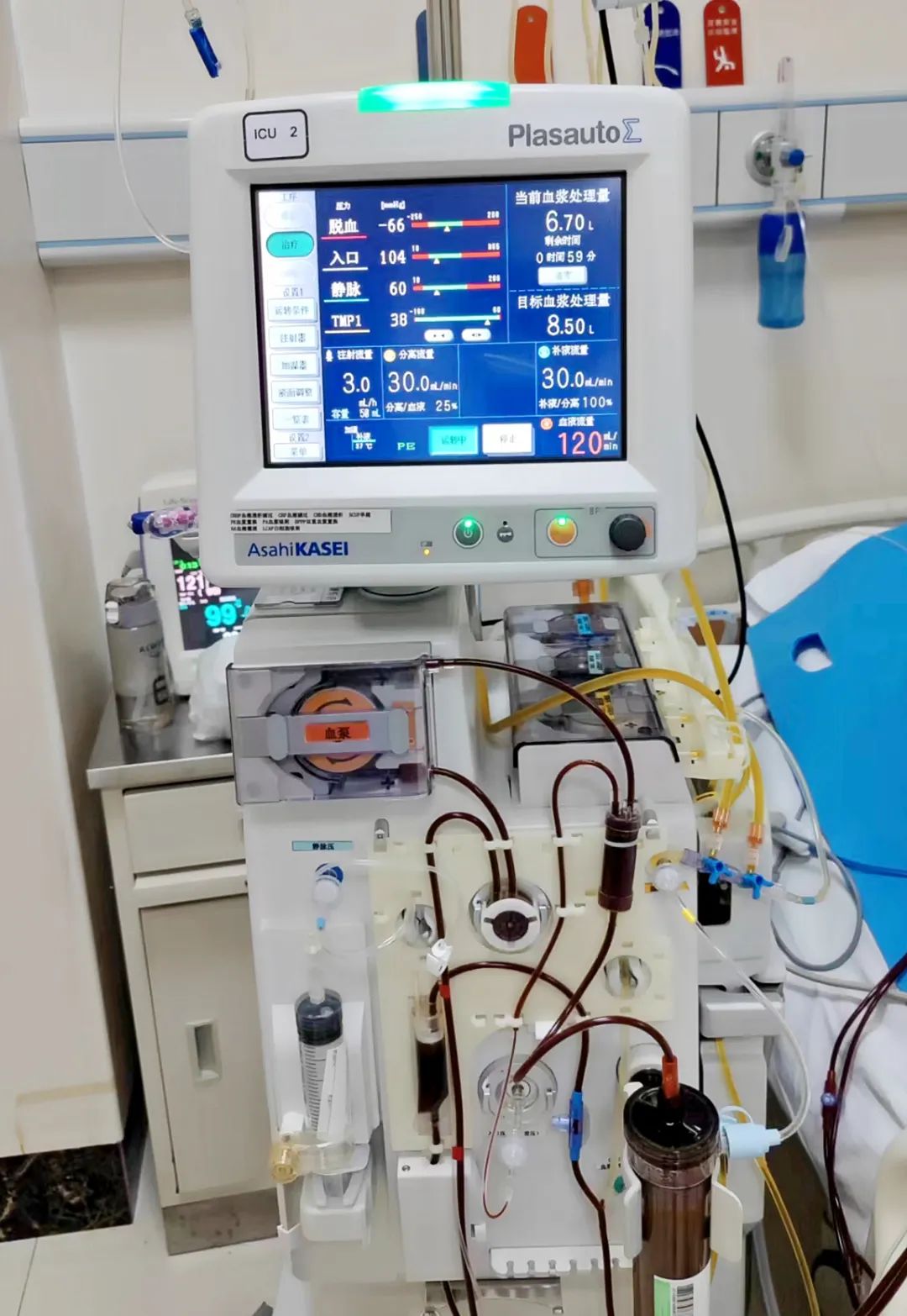 神奇“人工肝”，不再让你“肝”着急