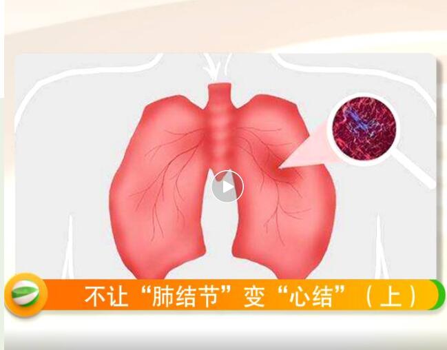 不让“肺结节”变“心结”(上) 不让“肺结节”变“心结”(上)