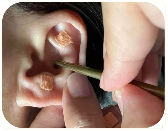 这么近、那么好,请到中医护理专科门诊体验中医养生之奇妙! 这么近、那么好,请到中医护理专科门诊体验中医养生之奇妙!